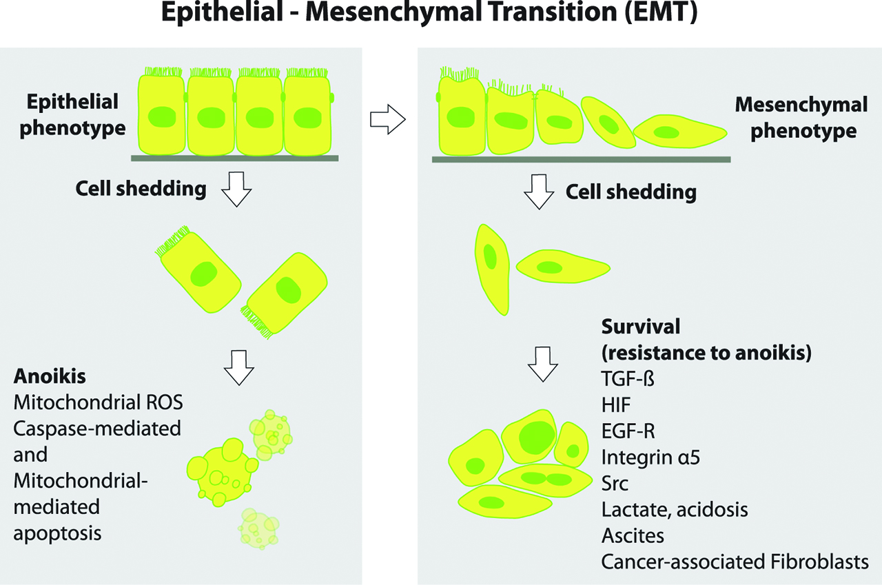 Figure 1: EMT and resistance to anoikis.Normal epithelial and premalignant cells undergo programmed cell death via anoikis upon detachment from the extracellular matrix/ tumor microenviroment (TME). Cancer cells develop resistance to anoikis and are able to survive in the peritoneal cavity despite shedding from the ECM/basement membrane. Key drivers of resistance to anoikis include TGF-β, Hypoxia-inducible factor (HIF), Epidermal-growth factor Receptor (EGF-R), Src, low pH, lactate, integrin α, heat shock protein (HSP), cytokines and the presence of Cancer-associated fibroblasts (CAFs) and ascites in the peritoneal cavity (Adapted from [15]).