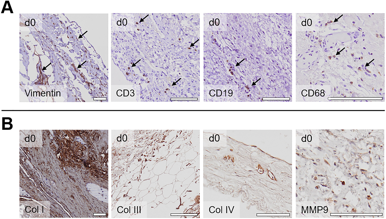Figure 2: 
Immunohistochemical characterization of peritoneal cells and ECM components.
(A) Staining for cellular markers before culture (day 0); vimentin: fibroblasts, CD3: T-lymphocytes, CD19: B-lymphocytes, CD68: macrophages; scale bars: 100 µm. (B) Staining for ECM components before culture (day 0); scale bars 100 μm.
