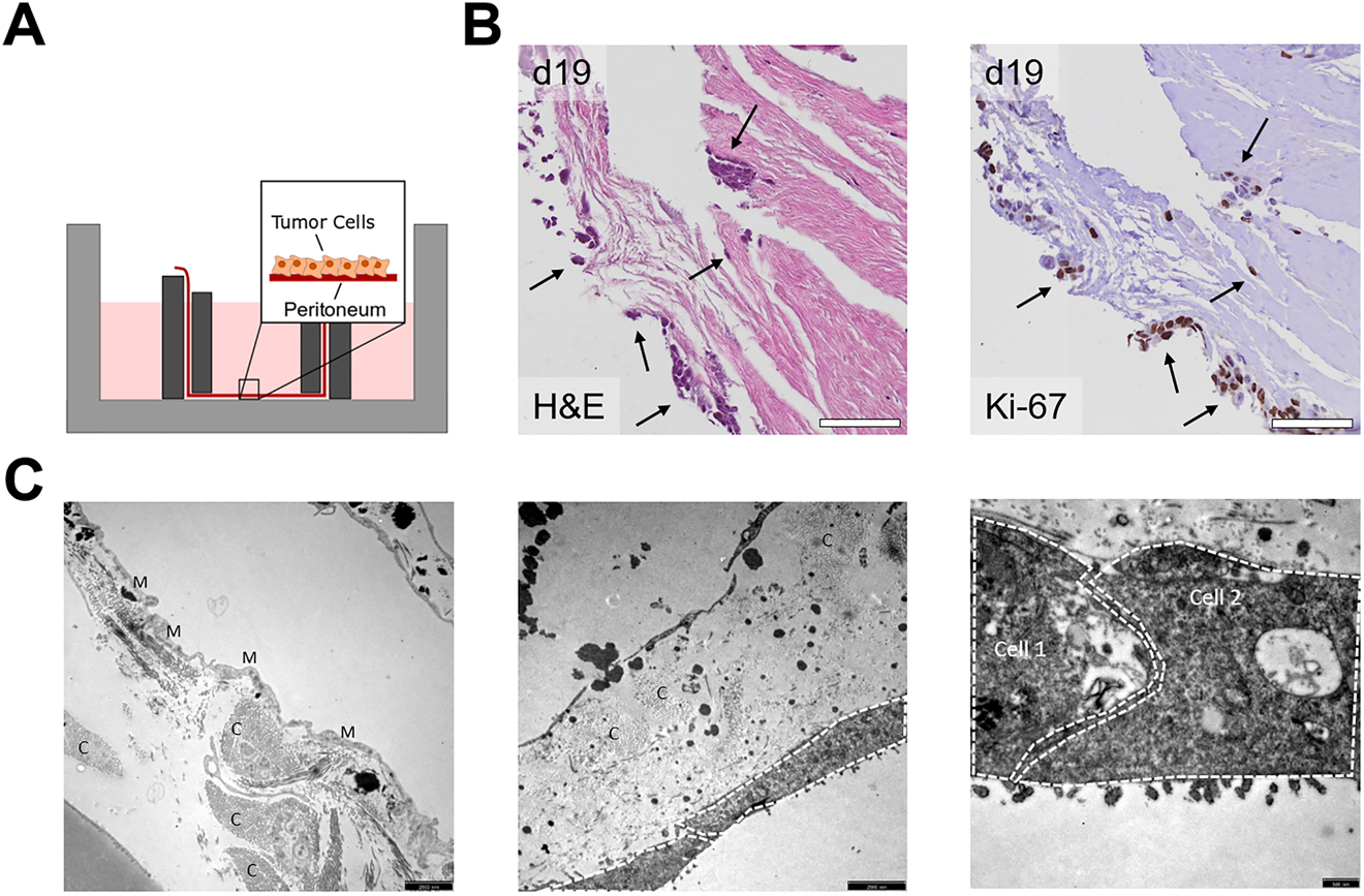 Figure 3: 
Establishment and characterization of a human ex vivo peritoneal coculture model.
(A) Schematic setup of the ex vivo peritoneal coculture model. (B) H&E and Ki-67 staining for cocultures with the CRC cell line HCT116 at day 19 after culture; attached and invading CRC cells are indicated by arrows; scale bars 100 µm. (C) EM images of human peritoneum without (left) and with HT29 cells (middle, right, indicated by white lines) before culture (day 0, left) and day 6 after coculture (middle, right); M: mesothelial cells, C: collagen, Cell 1 and Cell 2: HT29 cells grown on the peritoneum; scale bars 2500 nm (left, middle) and 500 nm (right).
