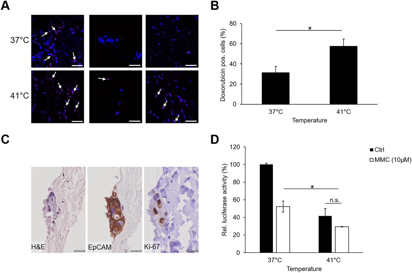 Figure 5: 

Ex vivo peritoneal model as a model system for hyperthermal chemotherapeutic treatment.
(A) Doxorubicin immunofluorescence (red) of the ex vivo peritoneal model treated with 10 µM doxorubicin for 90 min at 37 °C or 41 °C; doxorubicin (red), nuclei (blue); white arrows indicate doxorubicin-positive cells in three representative images; scale bar, 40 µm. (B) Percentage of doxorubicin-positive cells following treatment at 37 °C or 41 °C (n = 3; two-sided, paired Student's t test: p = 0.007). (C) Coculture of HT29-GFP/luciferase cells with human peritoneum. EpCAM and Ki-67 stainings on day 6 reveal living and proliferating cancer cells; Scale bar 20 µm. (D) Treatment with 10 µM MMC for 90 min at 37 °C or 41 °C reduces the amount of living HT-29-GFP/luciferase cells 3 days after treatment; shown is one representative of at least three independent experiments performed in triplicates; significance was calculated using a two-sided paired Student’s t test; p=0.003.
