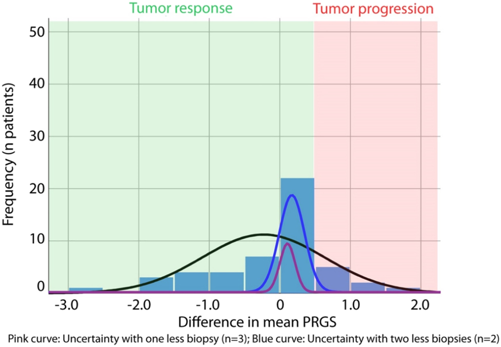 Figure 2:
Histological tumor response and informational loss induced by missing biopsies. The tumor response is measured as the absolute difference of the mean PRGS between two therapy cycles. Progression of disease (PD) is defined by an increase in the mean PRGS (red area). Tumor response (green area) is defined by an unchanged PRGS (stable disease, SD), a decrease in the mean PRGS (partial response, PR), or the absence of vital tumor cells in all biopsies (PRGS 1, complete response, CR). The pink curve shows the diagnostic uncertainty induced by one missing biopsies (= only three biopsies available), the blue curve by two missing biopsies (= only two biopsies available). Diagnosis of tumor progression is wrong when the diagnostic uncertainty is superior to the difference in the mean PRGS.