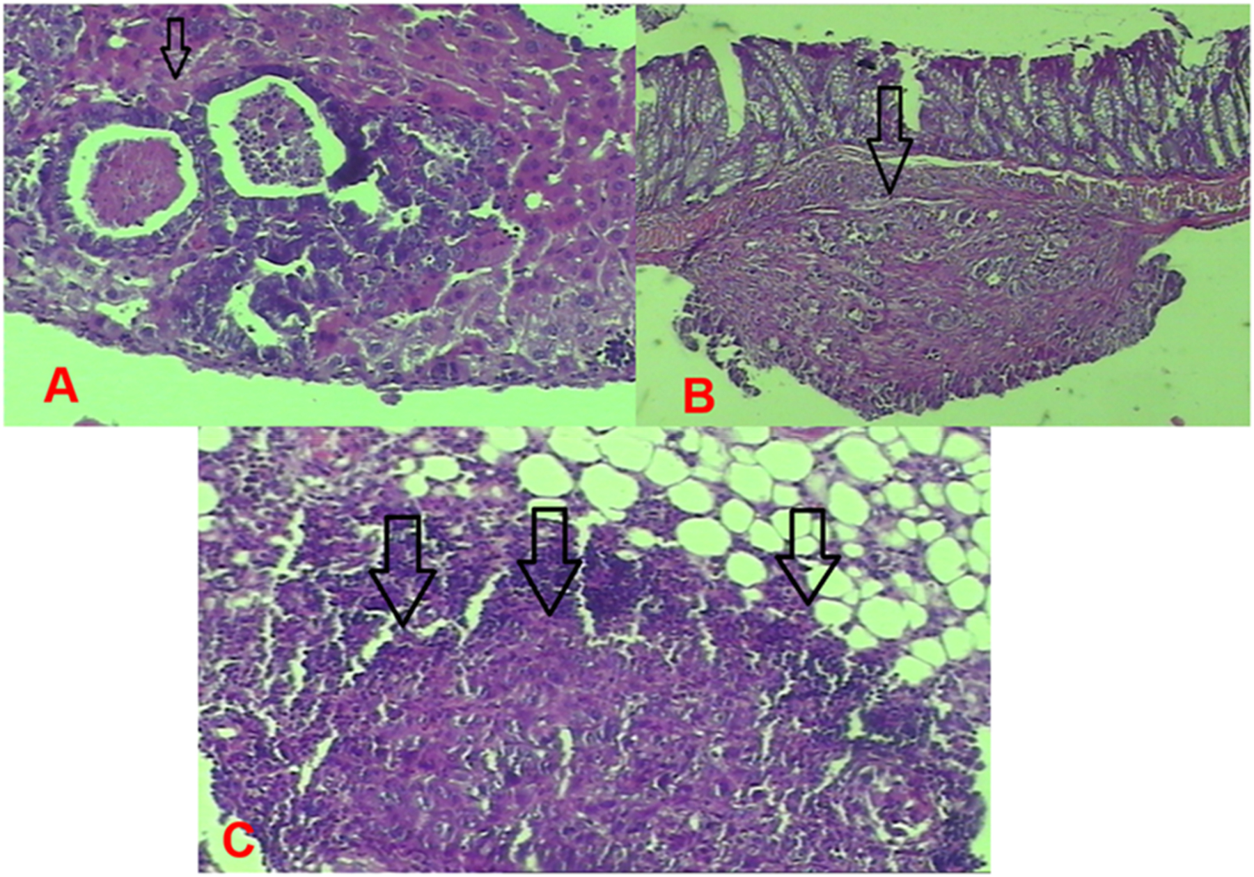 Figure 5: 
Group 1 (control) tumor images. (A) Nodular tumor implanted in the liver. (B) Tumor implantation in the intestinal wall. (C) Tumor infiltrating the peritoneal adipose tissue.
