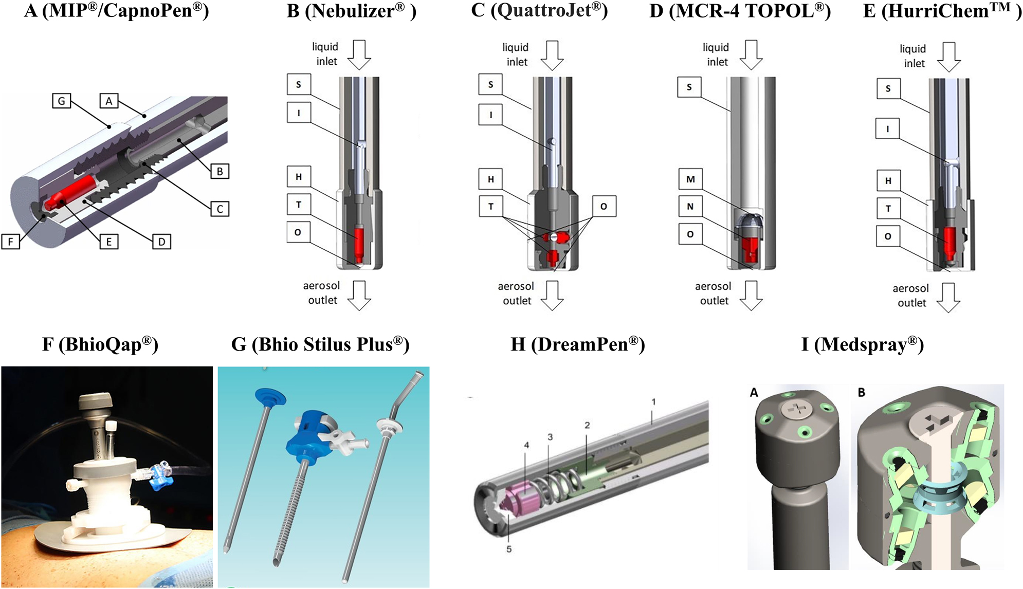 Figure 1: 
Nebulizers used for pressurized intraperitoneal aerosol chemotherapy (PIPAC). A: Original nebulizer. Reprinted from Göhler et al. 2017 [19]. B–E: clinically used nebulizers. Adapted from Göhler et al. 2024 [22]. F: Multifunction BhioQap device. Adapted from Seitenfus et al. 2018 [35]. G: The Bhio Stilus plus platform. Source: http://www.bhiosupply.com.br/ [37]. H: Korean-made nebulizer. Reprinted from Lee et al. 2020 [38]. I: high pressure and single fluid nebulizer. Adapted from Braet et al. 2023 [24].
