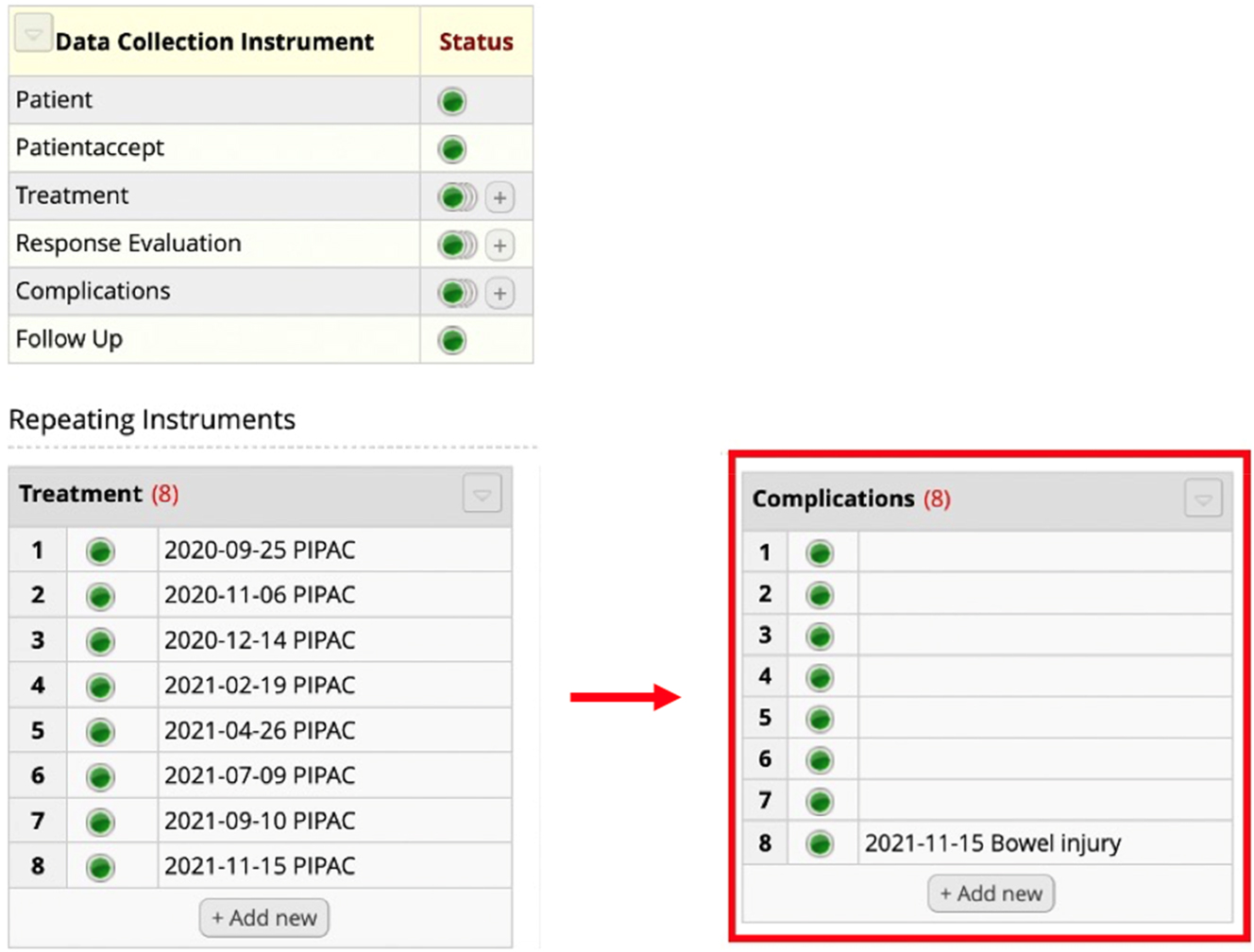 Figure 2: 
Incompleteness in the key element Complications. The patient was treated with eight PIPAC directed treatments. As highlighted in red, eight complications were registered but only one complication was provided with information as to the character of the problem (e.g., bowel injury). Seven of the complications had no registered data and are considered “empty.”
