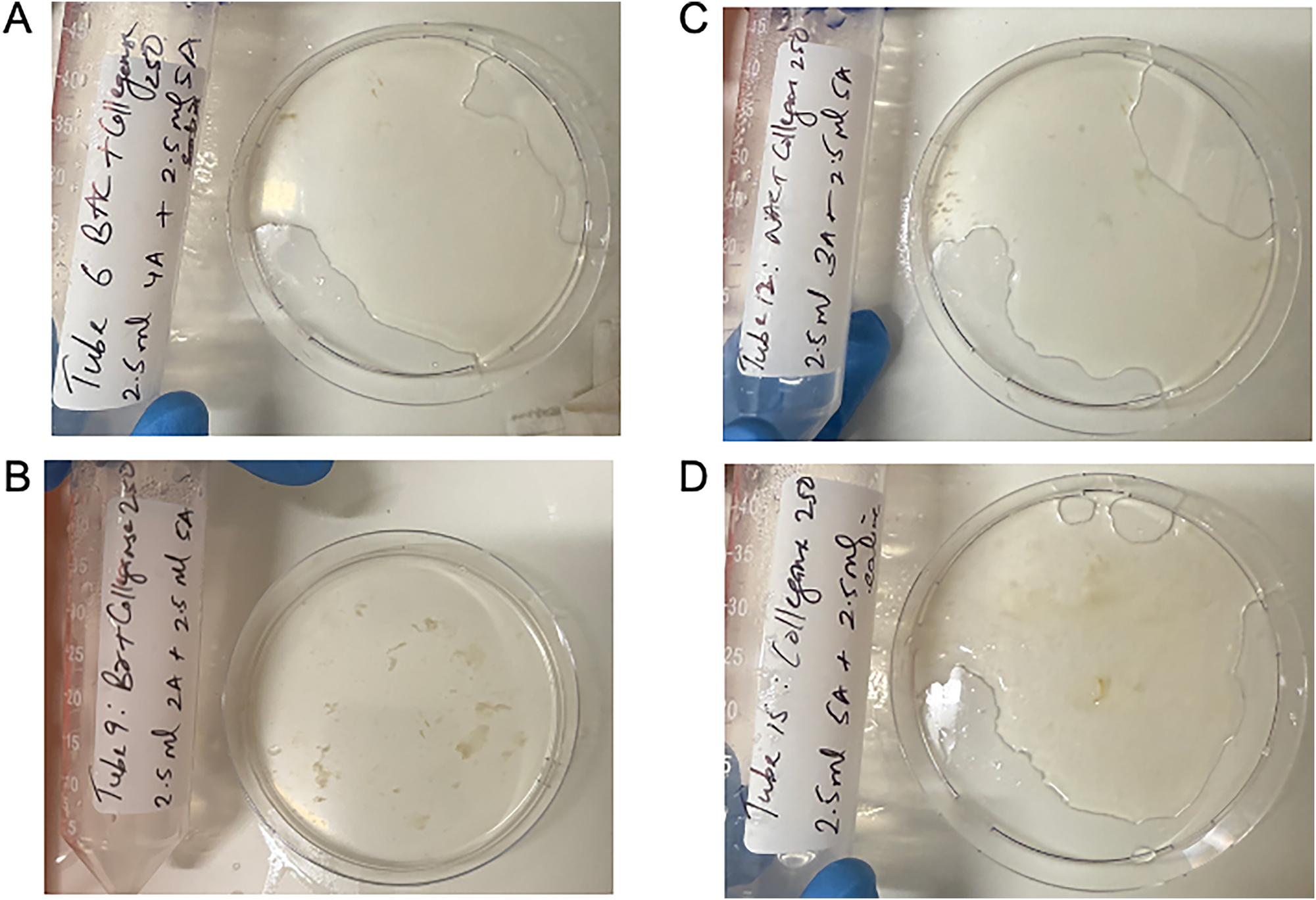 Figure 2:
Quality of hard mucin dissolution in BromAc, bromelain and NAC with collagenase 250 μg/mL and collagenase 250 μg/mL control after 24 h. A: BromAc + collagenase 250. B: Bromelain + collagenase 250. C: NAC + collagenase 250. D: Collagenase 250.
