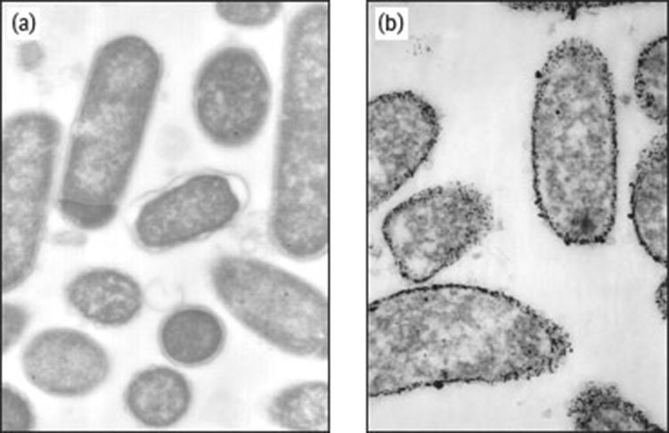 Fig. 12 STEM images of D. desulfuricans bacteria (a) before and (b) after impregnation with palladium metal. Reprinted from Bennett et al. © [54], with permission from Elsevier.