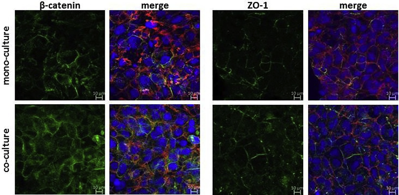 Figure 8: 
Comparison of expression of cell-cell contact markers β-catenin and ZO-1 for monoculture and coculture models using immunofluorescent staining. Transwell systems were prepared using 200,000 BeWo cells in monoculture and with 350,000 pericytes for coculture, and cultivated until day 4 PS; fixed and permeabilized cells were stained with rabbit anti–ZO-1 or β-catenin primary antibody followed by AlexaFluor® 488–labeled goat anti-rabbit secondary antibody (green), Hoechst 33258 (blue) and AlexaFluor® 633 Phalloidin (red) to visualize cell-cell contacts, cell nuclei, and cell cytoskeleton, respectively; fluorescence signals were acquired by cLSM; scale bar = 10 µm; PS = post seeding [133]. ZO = zonula occludens; cLSM = confocal laser scanning microscopy.
