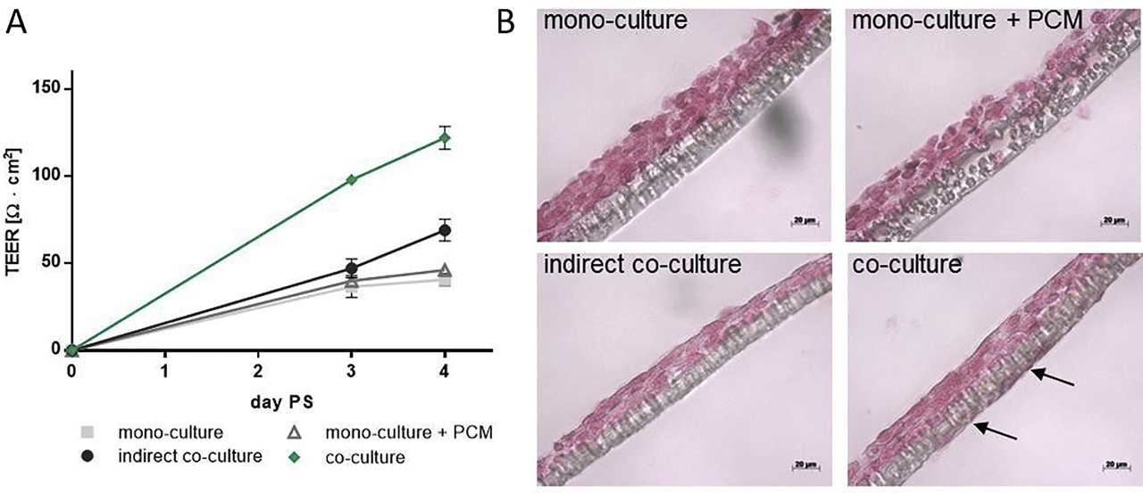 Figure 9: 
Investigation of the pericyte-associated effects in the BPB model using TEER and histologic slices. Transwell systems were prepared using 200,000 BeWo cells and (if applicable) 350,000 pericytes and cultivated for 3–4 days; conditions: coculture, monoculture, indirect coculture (pericytes on the bottom of the well), and monoculture + PCM. (A) TEER values were measured for day 3 and 4 PS; mean TEER values (Ω cm2) ± SD (n = 3) are shown. (B) Histologic slices of transwell membranes were prepared for day 4 PS; transwell membranes were embedded in paraffin and sectioned, and cells were stained with Nuclear Fast Red; arrows mark pericytes grown on the basolateral side of the membrane; scale bars represent 20 µm; PS = post seeding [133]. BPB = blood-placenta barrier; TEER = transendothelial electrical resistance; PCM = pericyte-conditioned medium; SD = standard deviation.
