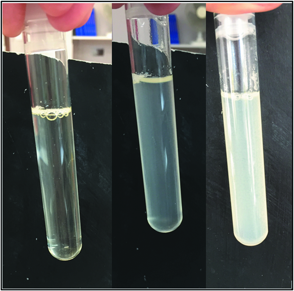 Figure 2: Mixture of amoxicillin (A) 20.83 mg/mL diluted in 5 % glucose with vancomycin (V) 31.25 mg/mL diluted in 5 % glucose after the mixture (left), after 5 minutes (middle) et after 30 minutes (right) (A:V (v:v): 5:5).