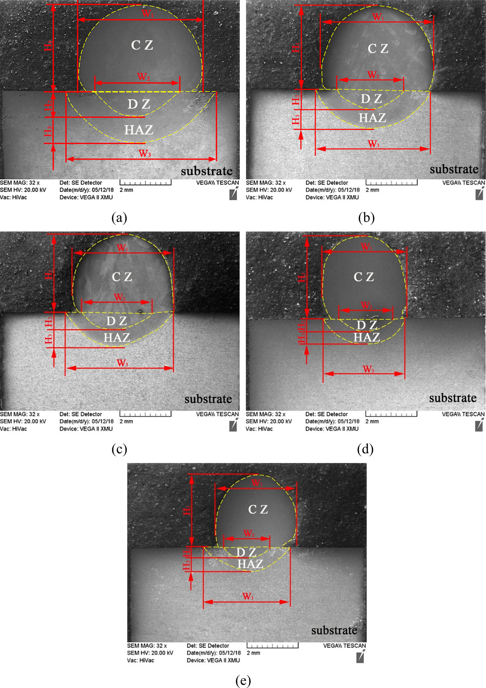 Figure 4
Cross-sectional morphologies of laser cladding layer of 304 steel obtained at different scan speeds V
s: (a) 4 mm·s−1; (b) 7 mm·s−1; (c) 10 mm·s−1; (d) 13 mm·s−1; and (e) 16 mm·s−1.