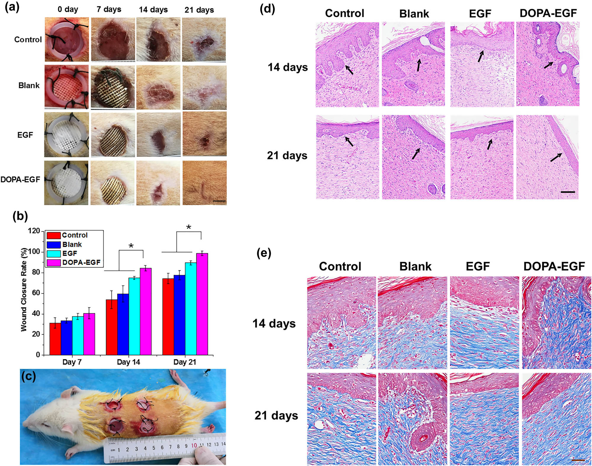 Figure 4 
               (a) Images of wound closure for control group, blank group, EGF group, and DOPA group at day 7, 14, and 21. (b) Wound closure rate for control group, blank group, EGF group, and DOPA group at day 7, 14, and 21. (c) Image of the excisional wound model (scale bar is 5 mm). (d) Images of H&E staining for different groups at day 14 and 21 (magnification is 200×, scale bar is 100 µm). (e) Masson’s trichrome staining for different groups at day 14 and 21 (magnification is 400×, scale bar is 50 µm). Reproduced with permission from Gao et al. [92].
            