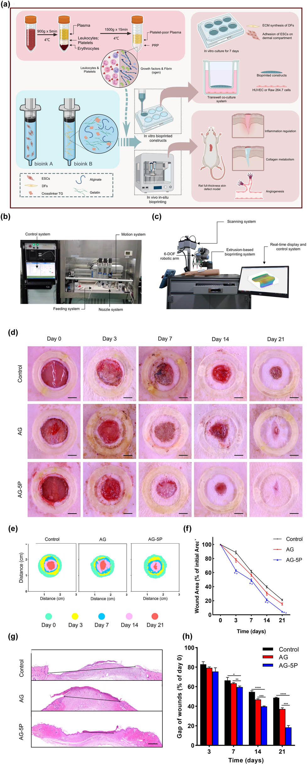 Figure 7 
                  (a) Schematic diagram of bioprinting process using PRP containing different component bioink. (b) Image of the in vitro extrusion-based bioprinting equipment. (c) Image of the robotic arm-based equipment for in situ bioprinting. (d) Images of wound closure for control group, AG group, and AG-5P group in 21 days (scale bar is 5 mm). (e) Images of wound closure in 21 days. Different colors represent the wound size at different times. (f) The wound area changes in 21 days. (g) Images of HE staining of the wound on day 21. (h) Quantitative results within 21 days. Reproduced with permission from Zhao et al. [112].
               
