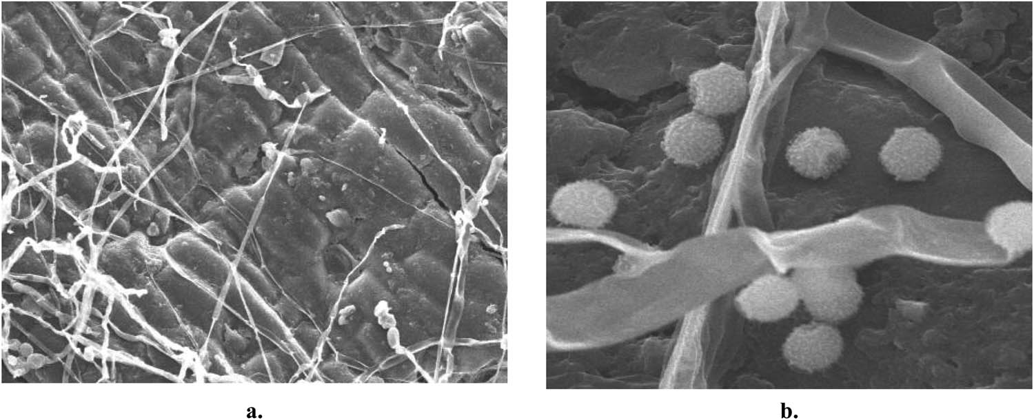 Figure 13 
               (a and b) TEM micrograph exhibiting the formation of green AgNPs of T. quadrivalvis.
               
            