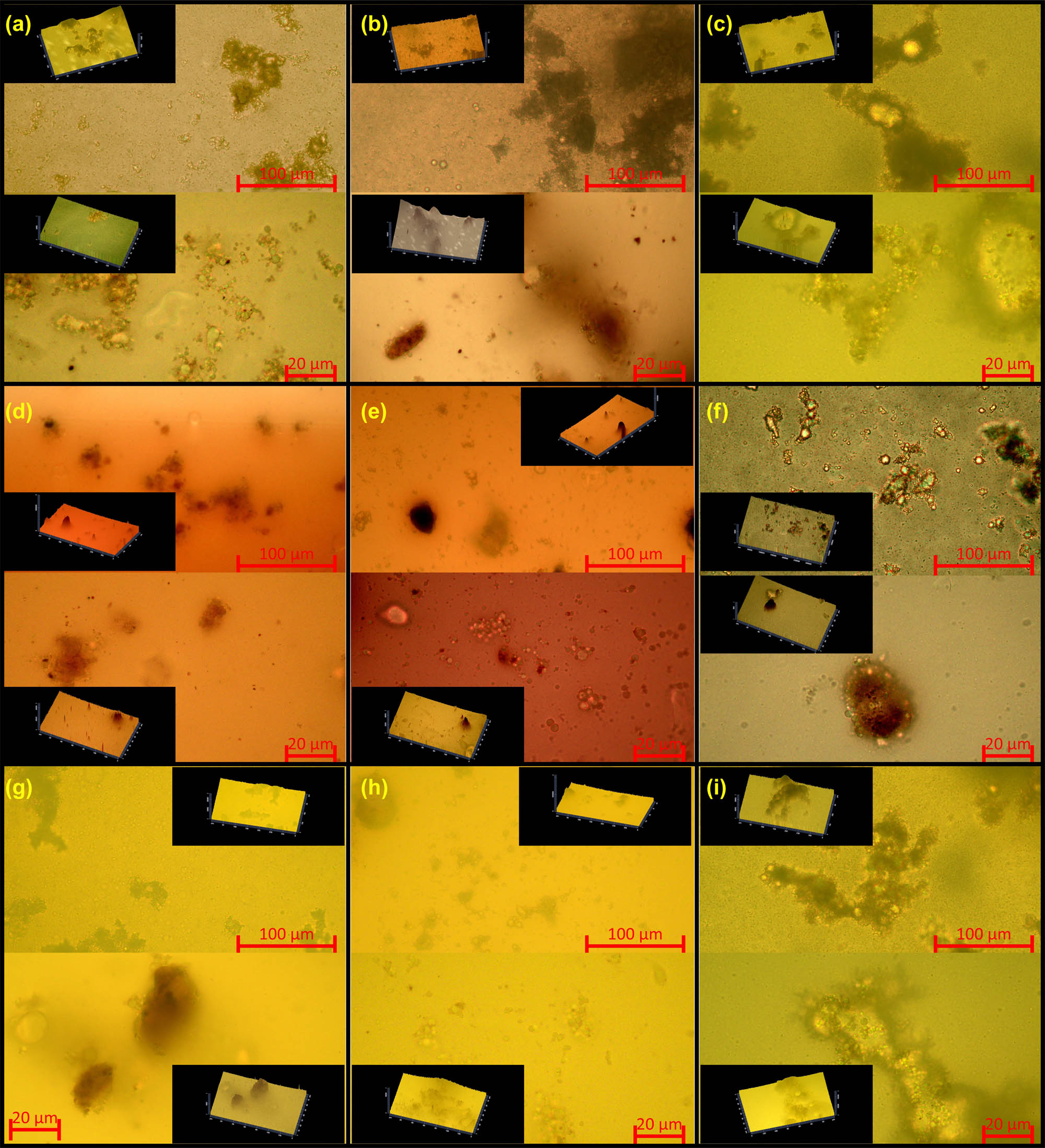 Figure 4
Microscopic images of the prepared emulsions (a–i) corresponds to HFD1–HFD9 (upper images in magnification 40×, under images in magnification 100×). Inserted images within 2.5D.