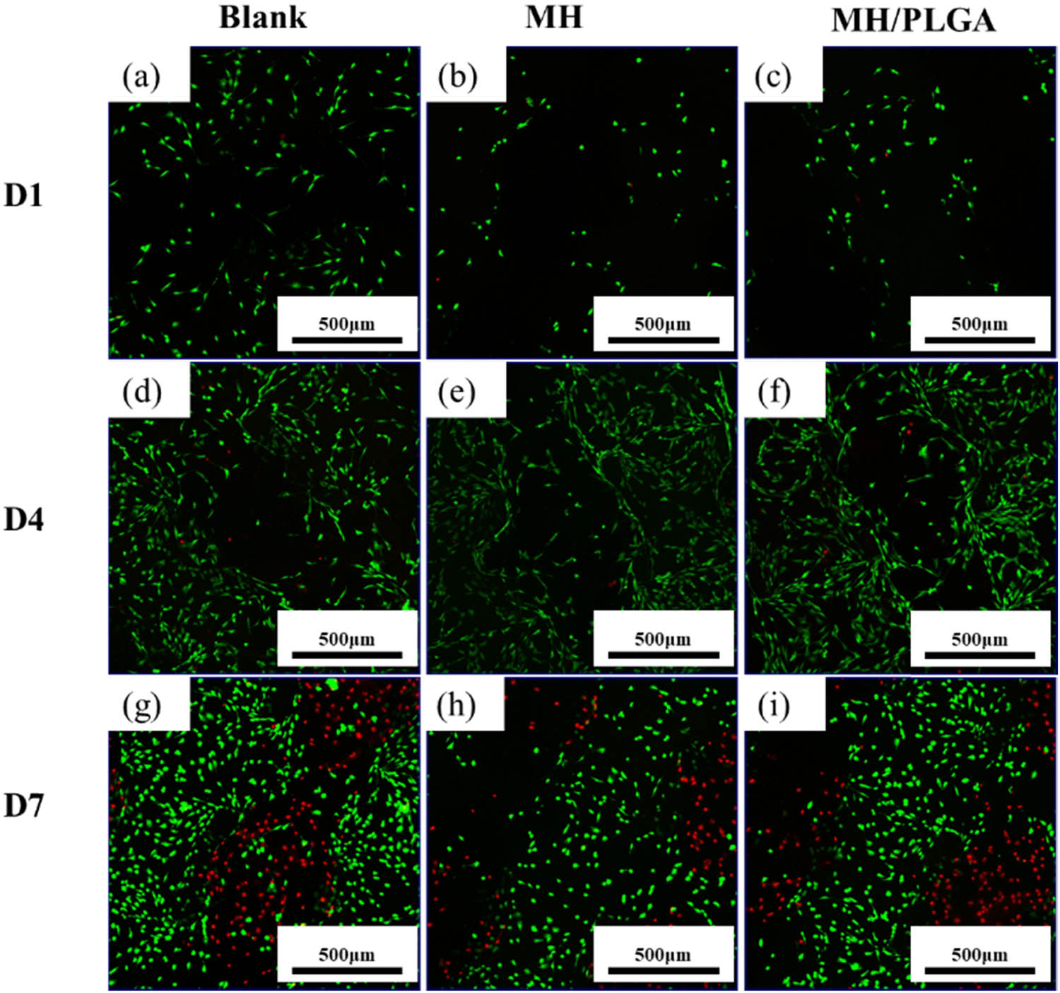Figure 11
Test of viable/dead cells on the scaffolds loaded with drug: (a)–(c) viable/dead cell staining on the first day, (d)–(f) viable/dead cell staining on the fourth day, and (g)–(i) viable/dead cell staining on the seventh day. The red dots are the dead cells and the green dots are the live cells.