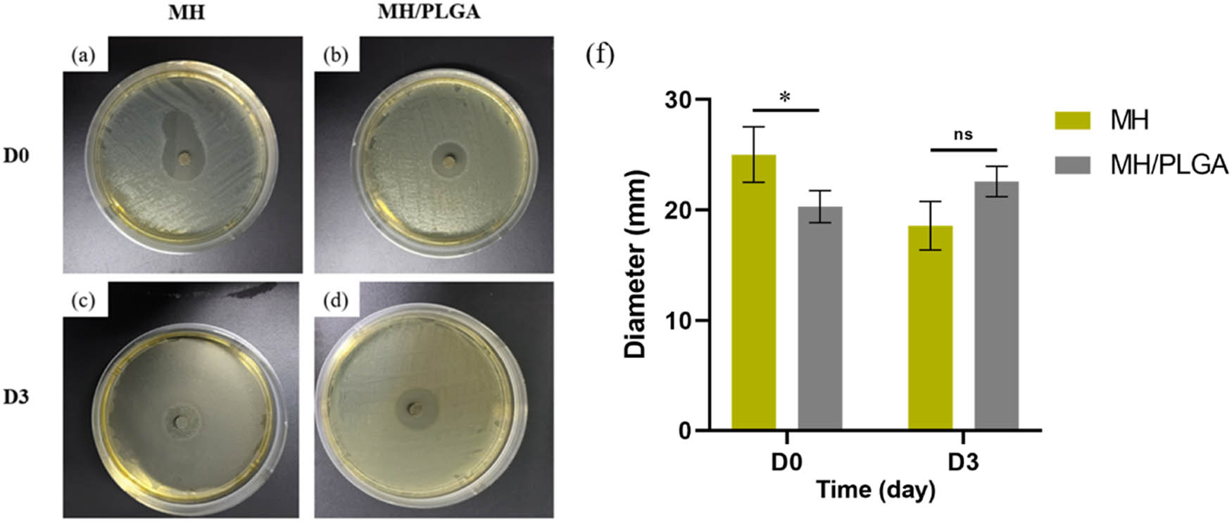 Figure 12
Anti-infection test results: (a) and (b) ZI of the two types of drug-loaded scaffolds before immersion, (c) and (d) ZI of the two types of drug-loaded scaffolds after immersion for 3 days, and (e) semi-quantitative results of ZI diameters. (Two-tailed t-test or one-way ANOVA with Tukey, *p < 0.05, **p < 0.01, and ***p < 0.001, error bars represent SD, n ≥ 3 independent experiments).
