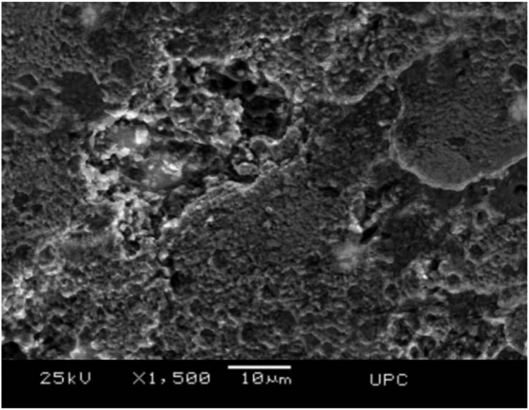 Figure 8 
               Pitting corrosion induced by carbide–matrix galvanic couples.