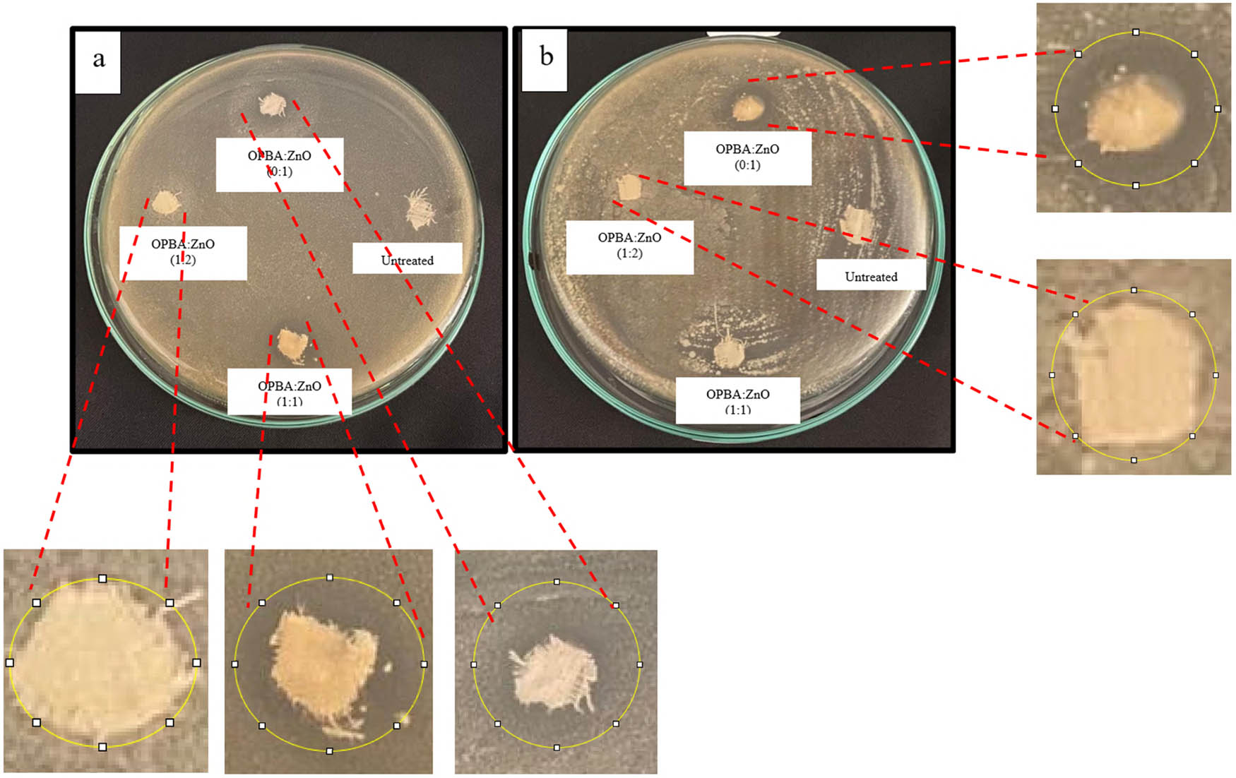  Figure 5 
                  Antibacterial activity of untreated and coated cotton fabrics against (a) S. aureus and (b) E. coli. Images show representative Petri dishes after 24 h of incubation. The inhibition zones (indicated by circles) represent areas where bacterial growth was inhibited. The diameter of each inhibition zone was measured in millimeters.
               