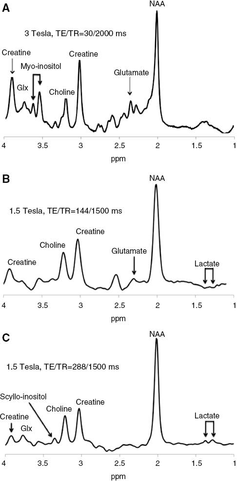 Figure 1: Representative 1H-MRS spectra acquired from human brain using three different TEs.The spectrum in A was acquired at TE=30 ms from the anterior cingulate cortex at 3 T. The spectra in B and C were acquired at TE=144 and 288 ms, respectively, from the primary visual cortex at 1.5 T. Selected metabolite peaks are indicated. Note that the ppm value on the horizontal axis increases to the left, not the right. Spectral peaks that appear on the right side of the graph arise from nuclei that are relatively more shielded from the main magnetic field by nearby electrons. Spectral peaks on the left side of the graph arise from relatively less shielded nuclei (discussed in ‘Chemical shift’).