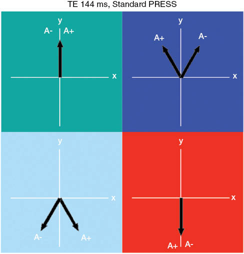 Figure 15: Reduced lactate signal resulting from volume misregistration with PRESS at TE 144 ms.The four colored boxes refer to the voxel regions shown in Figure 14. In each box, the A+ and A- labels identify the magnetization contributing to the two peaks of the lactate doublet. In the red region at TE 144 ms, the net effect of J-coupling is to add 180° to the phase of the magnetization of both peaks of the doublet, causing it to invert. However, in the other three regions of the voxel, the influence of the coupled nuclei on the doublet is different, with the light blue region adding to the inverted doublet and the teal and dark blue regions subtracting from it. For lactate at 1.5 and 3 T, the red region predominates; thus, the doublet appears inverted but is reduced in size (as seen in Figure 13).