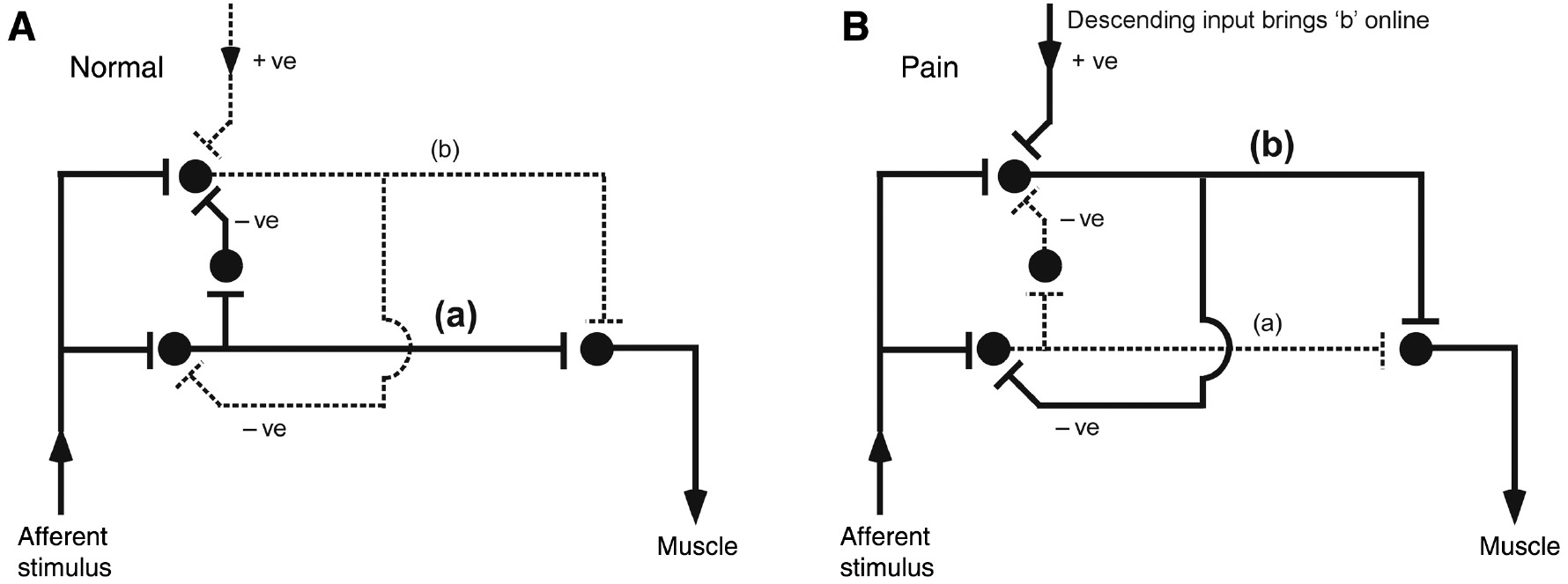 Figure 6: Possible neuronal pathways that would explain decreased reflex threshold in the absence of latency, duration or amplitude changes.(A) In normal state, the stimulus activates pathway ‘a’ to elicit a motor response. (B) In people with chronic pain, descending facilitatory input brings an alternative pathway ‘online’. Dotted line reflects inactive and solid line active pathways.