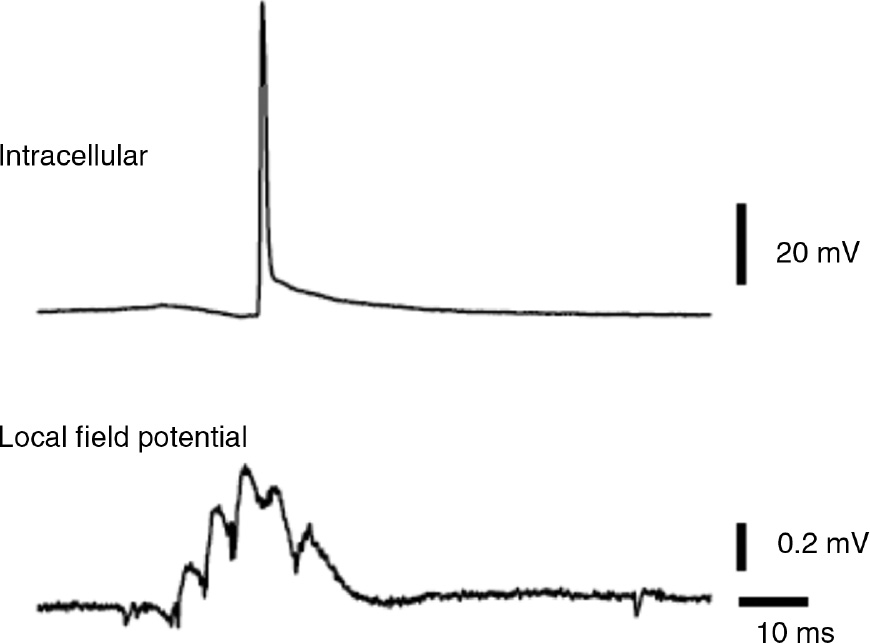 Figure 9: Antidromic (axonally generated) action potential during an in vitro sharp-wave/ripple.Spontaneous sharp-wave ripple in CA1 region of mouse middle hippocampal slice. Pyramidal cell somatic intracellular recording above, stratum pyramidale field potential below. Note how the intracellular action potential arises from a hyperpolarization. From Bähner et al. (2011).
