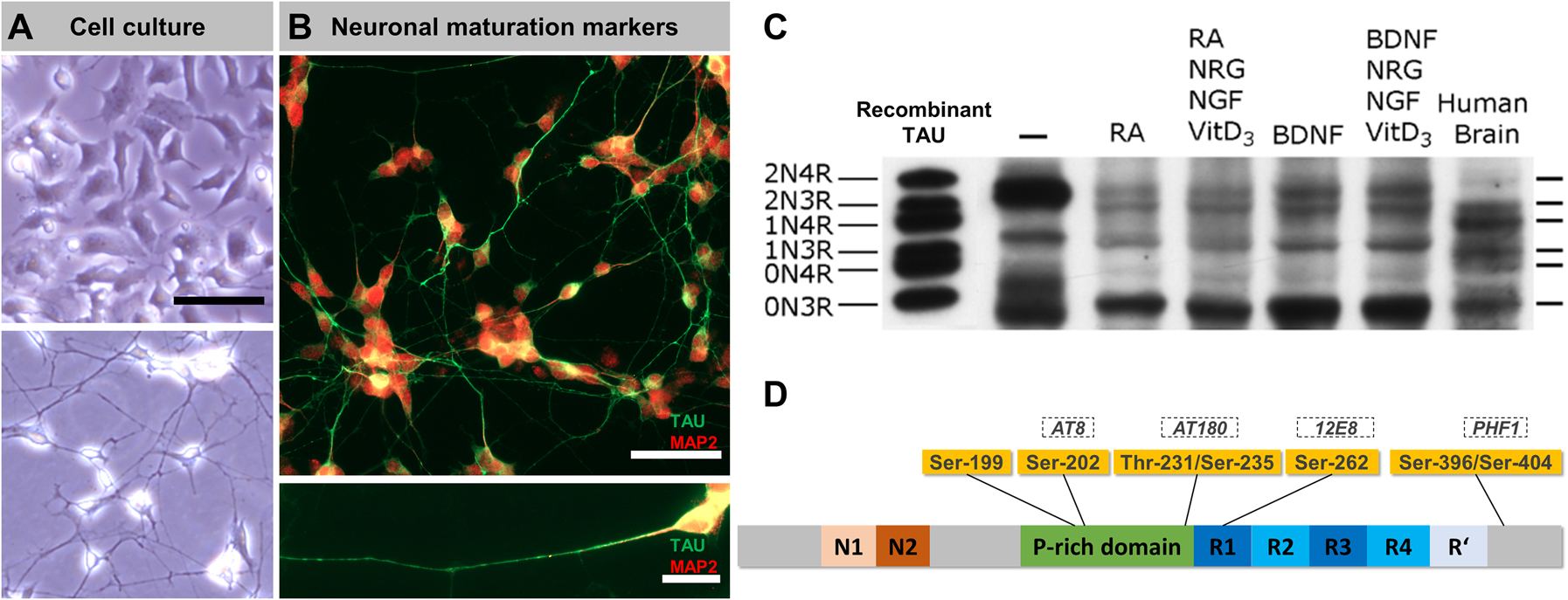 Figure 1: 
SH-SY5Y-derived neurons show axonal TAU enrichment and expression of all six human isoforms.
(A) Representative images of undifferentiated SH-SY5Y cells (top panel) and SH-SY5Y-derived neurons (bottom panel) in culture (cultures were grown on Poly-d-Lysine (20 μg/mL)-coated glass coverslips in Dulbecco's modified eagle medium (DMEM)/F12 (#10565018, Thermo Fisher) and 10% fetal bovine serum (BioChrom AG)); for differentiation, cells were grown for seven days in DMEM/F12, 10% fetal bovine serum and 10 µM retinoic acid (RA), followed by seven days in serum-free DMEM/F12 and 10 ng/mL brain-derived neurotrophic factor (BDNF). Note the altered morphology and pronounced neurite outgrowth upon differentiation. Scale bar: 50 µm. (B) Immunostainings of SH-SY5Y-derived neurons (cells were fixed with 3.7% FA for 1 h, blocked with 5% bovine serum albumin (BSA) and 0.1% Triton X-100 for 5 min, immunostained with polyclonal anti-TAU (K9JA, 1:1000 in phosphate-buffered saline (PBS), A0024, Dako, second AB: donkey anti-rabbit + AlexaFluor488, 1:1000 in PBS, A21202, Thermo Fisher) and chicken anti-MAP2 (1:2000, ab5392, Abcam, second AB: goat anti-chicken AF647, 1:1000 in PBS, A21449, Thermo Fisher) antibodies, and mounted (PolyMount, Polysciences), procedure adapted from Zempel and Mandelkow (2017)) demonstrate the strong expression and polarized distribution of neuronal maturation markers TAU (green, mainly axonal) and MAP2 (red, mainly somatic). Scale bar (top): 50 µm, scale bar (bottom): 20 µm. (C) Western blot analysis of TAU isoform expression (de-phosphorylated lysates) in undifferentiated SH-SY5Y cells (lane 1), differently treated SH-SY5Y-derived neurons (lanes 2–5) and human brain lysate (lane 6). The very left lane shows a recombinant TAU standard. Note the abundance of all six isoforms upon differentiation with varying ratios compared to the human brain. The blot was adapted and modified from Agholme et al. (2010). (D) Overview of the TAU protein (grey bar, colored sections indicate distinct TAU domains) and common tauopathy-associated TAU hyperphosphorylation sites (yellow boxes, corresponding epitopes recognized by specific antibodies are indicated in dashed boxes) that appear highly phosphorylated in SH-SY5Y cells.
