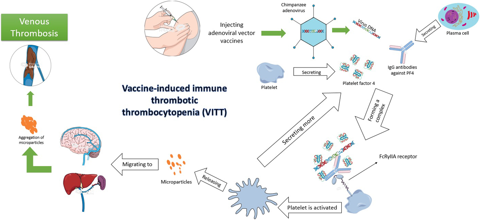 Figure 2:
Vaccine-induced thrombotic thrombocytopenia pathophysiology (created by mindthegraph.com).