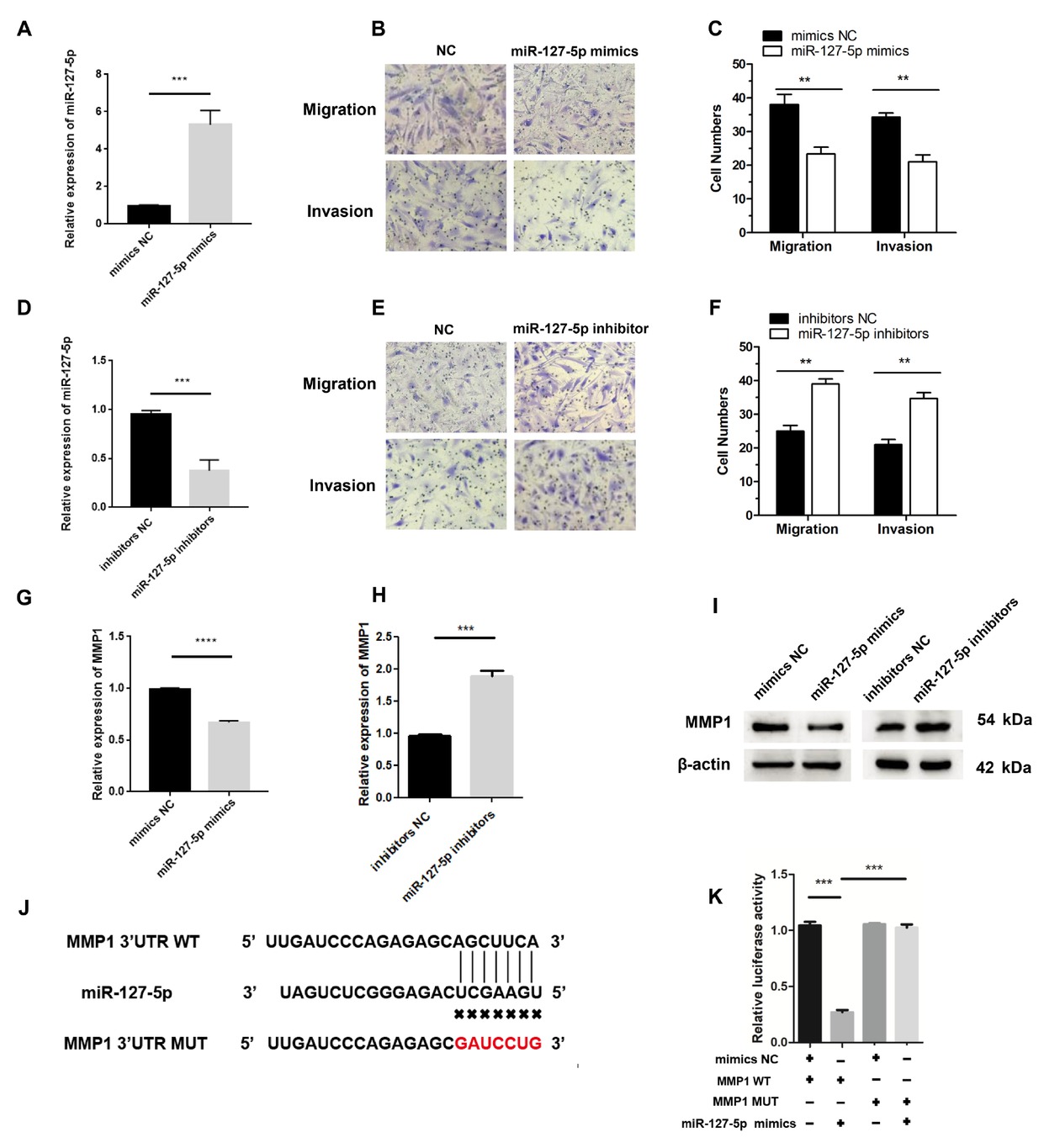 Figure 4 miR-127-5p inhibits RA-FLS migration and invasion. (A) RA-FLS were transfected with the miR-127-5p mimics or the negative control (NC). The expression level of miR-127-5p was determined using qRT-PCR. (B-C) Migratory and invasive activities of RA-FLS were assessed using Transwell migration and Matrigel invasion assays. RA-FLS were transfected with miR-127-5p mimics. (D) The expression level of miR-127-5p was analyzed by qRT-PCR. RA-FLS were transfected with miR-127-5p inhibitors. (E-F) Migratory and invasive activities of RA-FLS were assessed using Transwell migration and Matrigel invasion assays. RA-FLS were transfected with miR-127-5p inhibitors. (G-H) MMP1 mRNA expression was detected using qRT-PCR. RA-FLS were transfected with miR-127-5p inhibitors or miR-127-5p mimics. (I) Western blotting analysis of MMP1 levels. RA-FLS were transfected with miR-127-5p inhibitors or miR-127-5p mimics. (J) Wild-type (WT) or mutant (MUT) miR-127-5p target sequences in the MMP1′ untranslated region (UTR). (K) The relative luciferase activities were detected in RA-FLS co-transfected with luciferase reporter plasmids containing WT or MUT MMP1 sequences and miR-127-5p mimics. Data are shown as the mean ± SD. NS: not significant. * P < 0.05, ** P < 0.01, ***P < 0.001.
