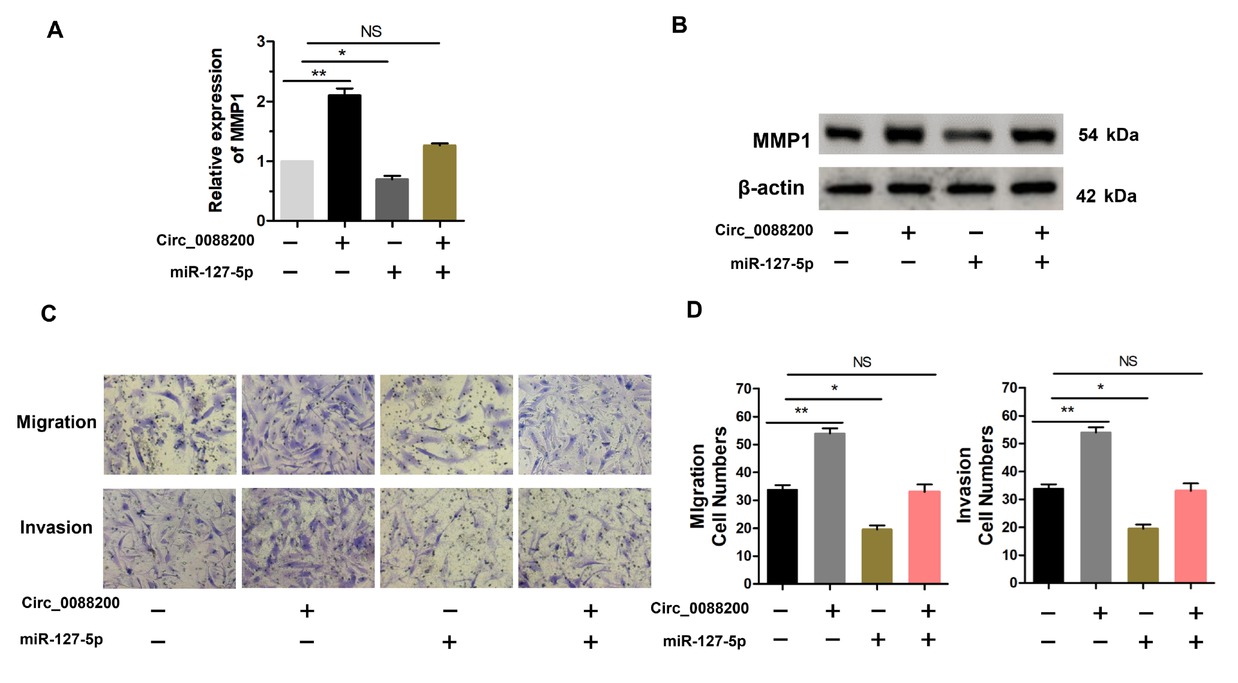 Figure 5 Circ_0088200 promotes RA-FLS migration and invasion via the miR-127-5p/MMP1 axis. (A) The expression of MMP1 mRNA was detected using qRT-PCR in RAFLS cotransfected with miR-127-5p mimics and adenovirus expressing Circ_0088200. (B) Western blotting analysis of MMP1 levels in RA-FLS after cotransfection with miR127-5p mimics and adenovirus expressing Circ_0088200. (C-D) The migratory and invasive abilities of RA-FLS were assessed using Transwell migration and Matrigel invasion assays. RA-FLS were co-transfected with miR-127-5p mimics and adenovirus expressing Circ_0088200. Data are shown as the mean ± SD. NS: not significant. *P < 0.05, **P < 0.01, ***P < 0.001.