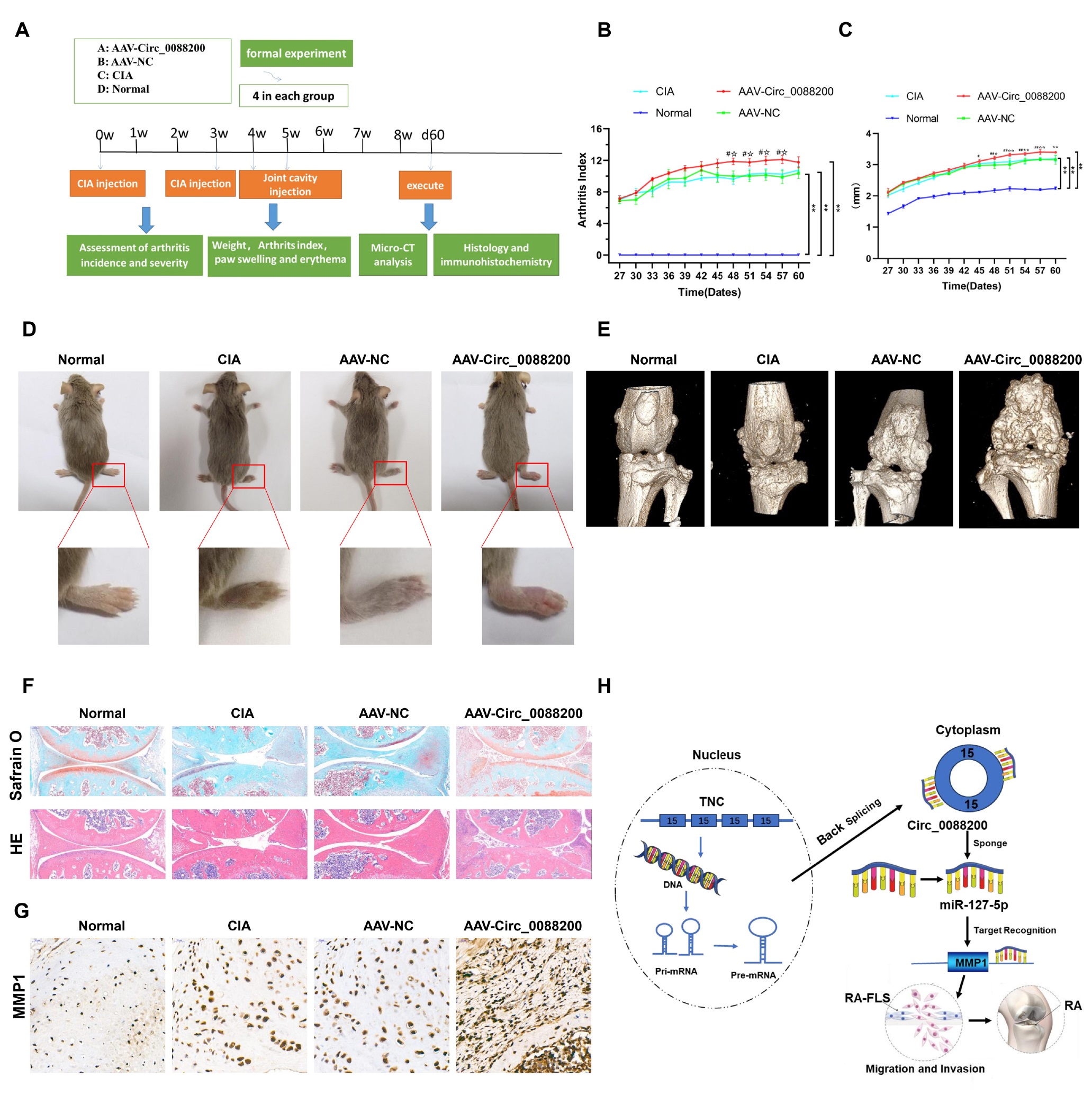 Figure 6 Circ_0088200 aggravates the severity of arthritis in a model of RA. (A) The flowchart for constructing the CIA mouse model (four mice per group). (B) Intra-articular injection of adeno-associated virus vector encoding Circ_0088200 (AAV-Circ_0088200) increased the arthritis scores compared with those in the Adeno-associated virus empty vector (AAV-NC) group and CIA group. (C) Intra-articular injection of adeno-associated virus vector encoding Circ_0088200 increased paw thickness compared with that in the AAV-NC group and CIA group. (D) Representative images of the CIA mouse model. (E) Three-dimensional reconstruction of a CIA mouse knee joint in MicroCT. (F) Representative H& E staining and Safranin O-fast green staining of knee joint sections showing increased cartilage erosions in the AAV-Circ_0088200 group. Scale bar=100 μm. (G) Representative immunohistochemistry sections showing that intra-articular injection of adeno-associated virus vector encoding Circ_0088200 upregulated the expression of MMP1 in the CIA mouse model. Scale bar= 50 μm. (H) Schematic showing that Circ_0088200 promoted the migration and invasion of RA-FLS by sponging miR-127-5p. Data are shown as the mean ± SD. NS: not significant. *P < 0.05, **P < 0.01, ***P < 0.001.