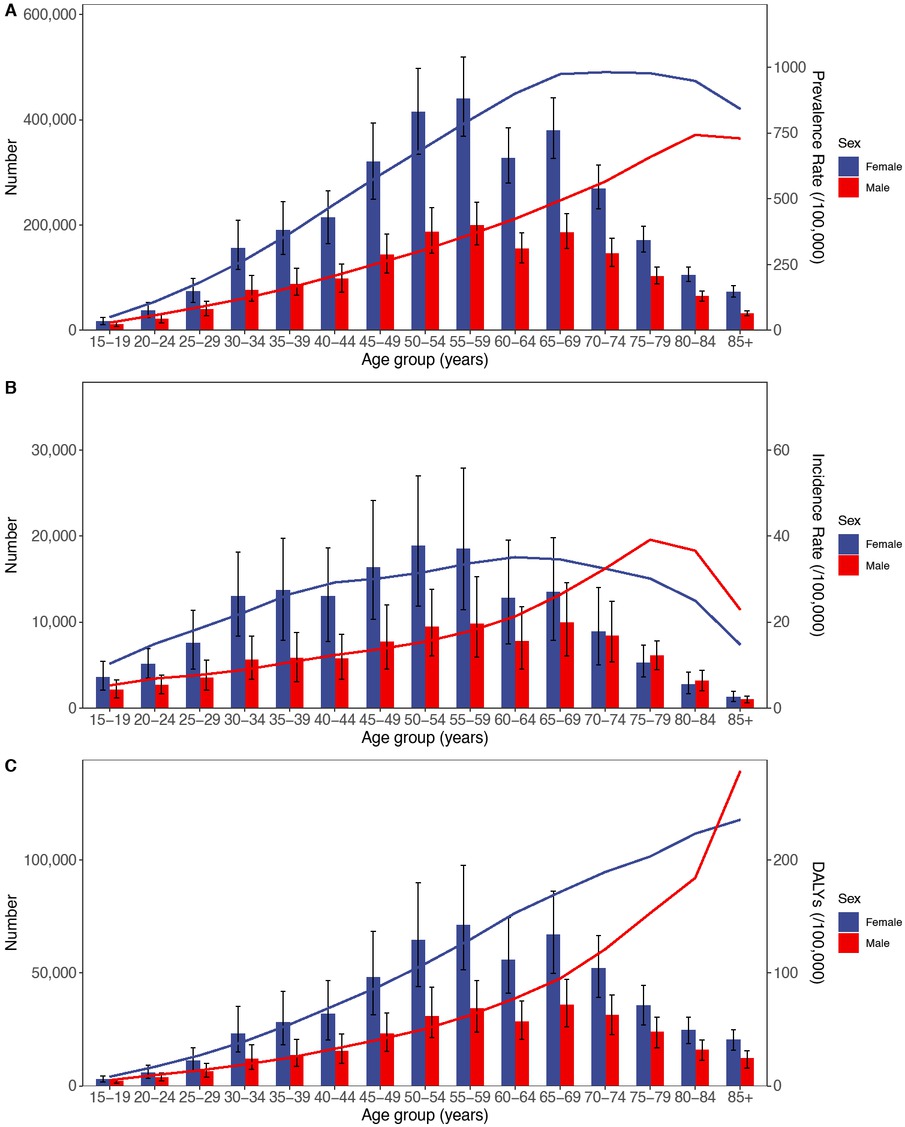 Figure 2 Age-specific numbers and rates of prevalence, incidence, and DALYs of RA by age and gender in 2021. (A) Prevalence, (B) Incidence, and (C) DALYs. DALYs, Disability adjusted life years; RA, Rheumatoid arthritis.