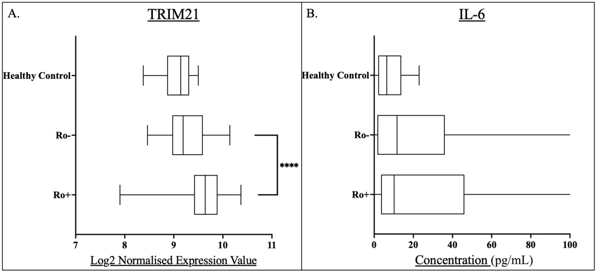 Figure 4 Box and whisker plots for anti-Ro positive (Ro+) and anti-Ro negative (Ro-) pSS patients and compared to healthy controls for A) whole blood TRIM21 transcript levels, and B) serum IL-6 concentrations. Levels of statistical significance were denoted as follows: P< 0.05. Levels of significance are shown by Asterix number: ****P<0.0001. Median values were shown within the box plots.