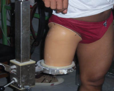 Figure 12: Static comfort test of socket prosthesis [25].