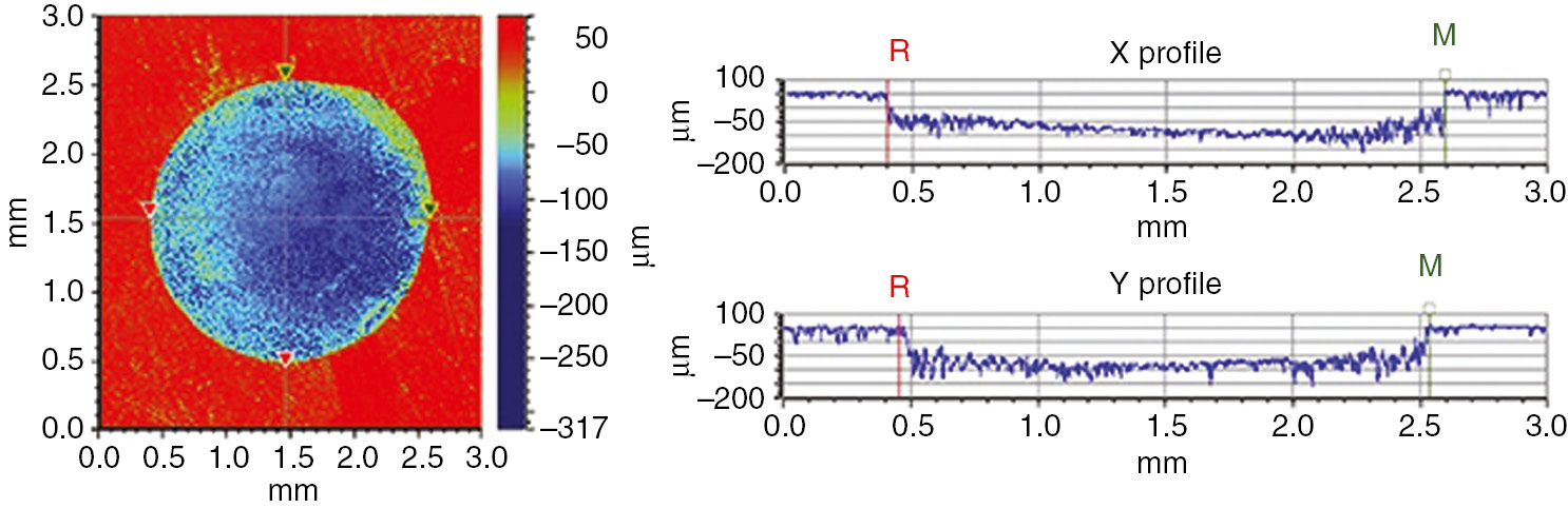 Figure 3: 2D analysis example of the Filtek Supreme composite material.