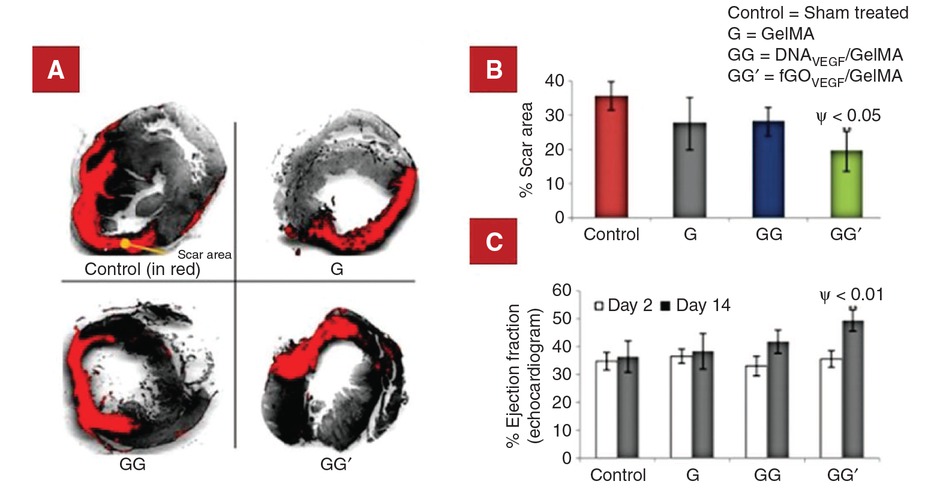 Figure 4 The assessment of the in vivo scar areas and cardiac function of infarcted hearts treated with GG‘ hydrogel (GelMA hydrogel carrying fGOVEGF (pDNAVEGF bound to fGO)) therapy. (A) and (B) The scar area determination by morphometric analysis of the left ventricle in different groups. The representative images of the left ventricle myocardial sections stained with sirius red show the cardiac fibrosis regions (in red). Sham operated and untreated infarcted group were used as controls. The red area represents the ECM deposition in the scar tissue and the gray area represents the myocardium. (C) Echocardiographic assessment of cardiac function. The heart ejection fraction (EF%) was monitored at days 2 and 14 post-treatment. p < 0.0001; ***p < 0.001, **p < 0.01, *p < 0.05 vs. time-matched control (n = 7). The p-values comparing time-matched GG′ and GG are indicated by ψ. This is an unofflcial adaption of Ref. [9] that appeared in an ACS publication. ACS has not endorsed the content of this adaption or the context of its use.