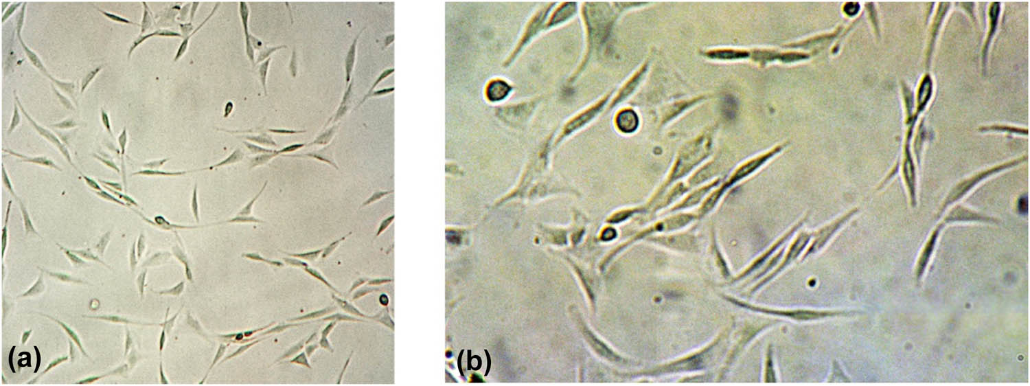Figure 1 
                  MC3T3-E1 cells 1 day after subculture. (a) (×40 magnification) and (b) (×100 magnification).