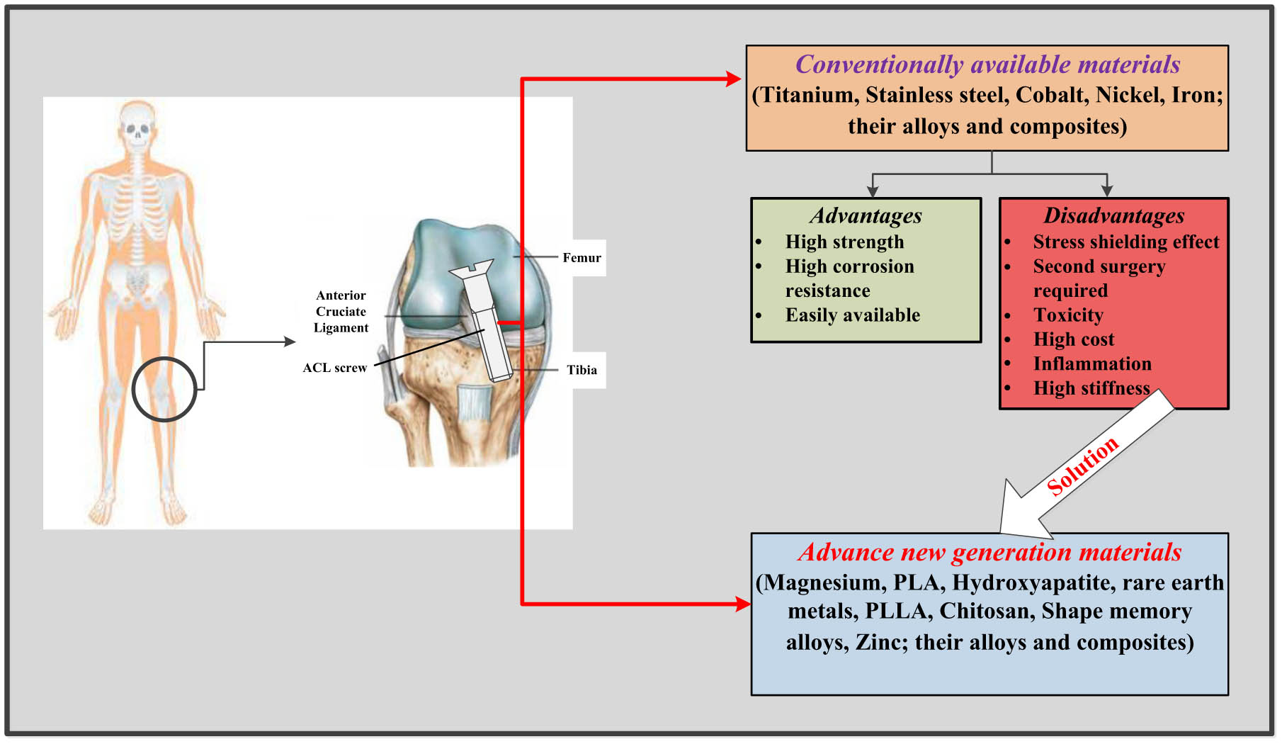 Figure 1 
               A pictorial view representing the ACL fixation and its implant materials.
            