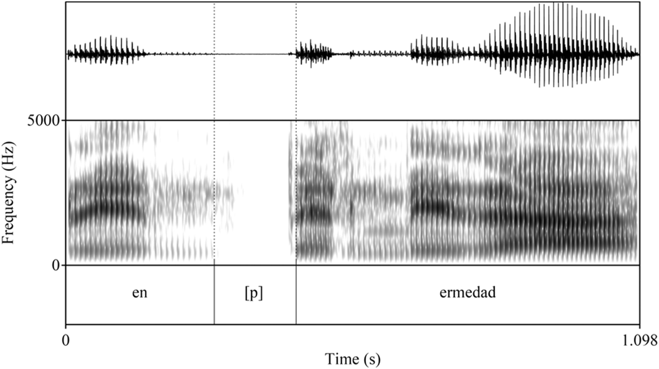 Figure 5: 
Waveform, spectrogram, and textgrid of [p] token in enfermedad ‘illness/disease’.
