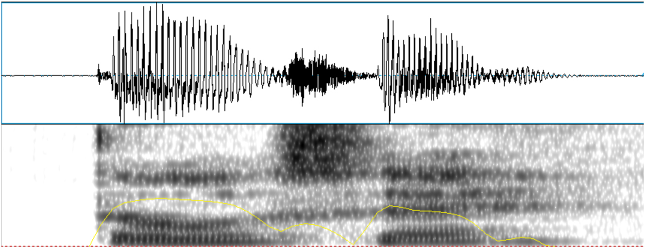 Figure 2:
Example of a voiceless stop production of /d/ in the word /ˈdose/ ‘twelve’ (speaker F).