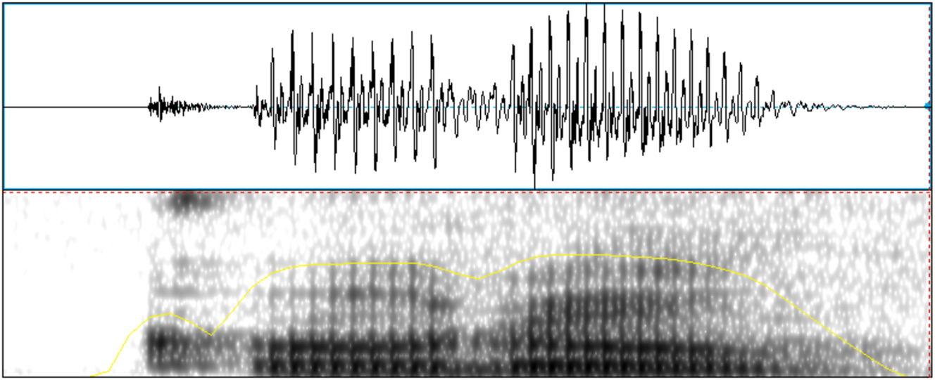 Figure 5:
Example of a tap production of /d/ in the word /ˈkodo/ ‘elbow’ (speaker Q).