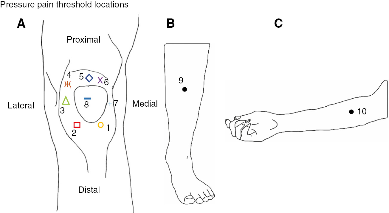 Fig. 1: 
            Location of the assessed eight pressure pain threshold (PPT) points on the knee (A) and the two control points (B and C).
          