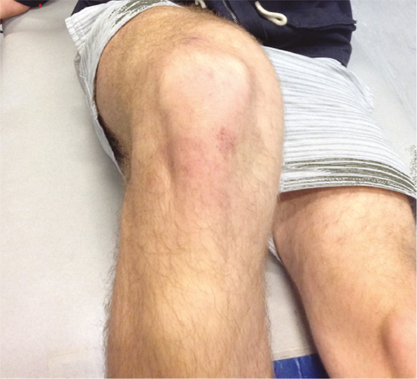 Fig. 1: 
              The final image utilised, over which pain maps were drawn.
            