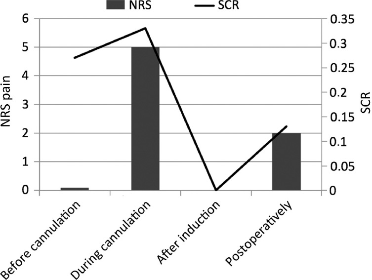 Fig. 3: 
          Median measured skin conductance responses per second (SCR) and median reported pain with the numeric rating scale (NRS) at the different time points.
        