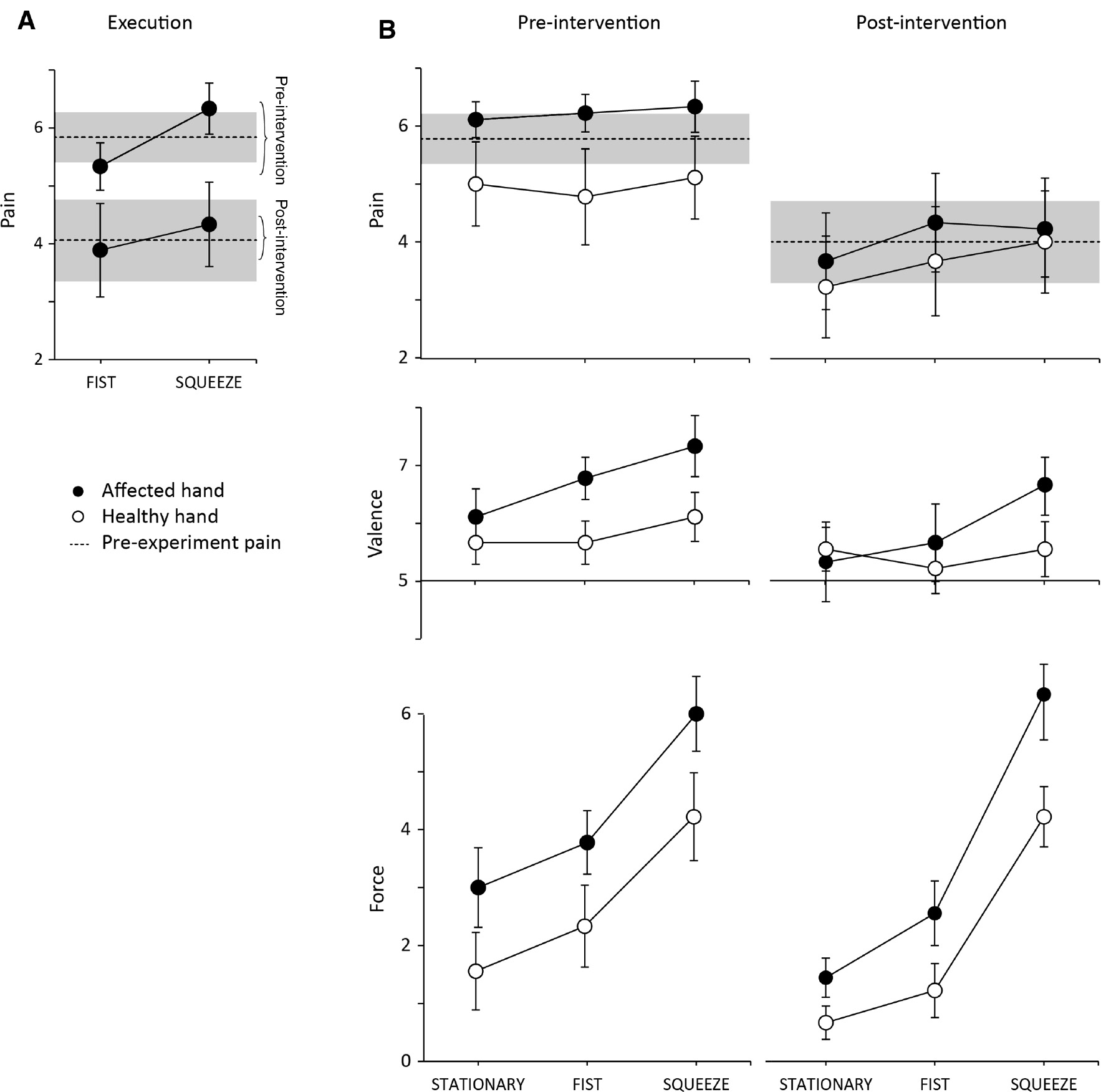Fig. 5: 
            Responses to visual sensorimotor actions. Pre- and post-intervention NRS-11 ratings (mean±SEM) for (A) hand action, and (B) Hand action observation. Pain: in post-intervention, patients began the experiment with lesser rest pain (pre-experiment pain: p<0.05, Wilcoxon signed-rank test). The difference was apparent also during action execution (p<0.05, ANOVA) and observation (p<0.05, ANOVA). Valence: The action observation was less unpleasantness after the intervention (p<0.05, ANOVA). Force: ratings of applied force for STATIONARY and FIST videos were decreased, i.e. closer to normal (p<0.05 and p<0.01, respectively, ANOVA) [14].
          
