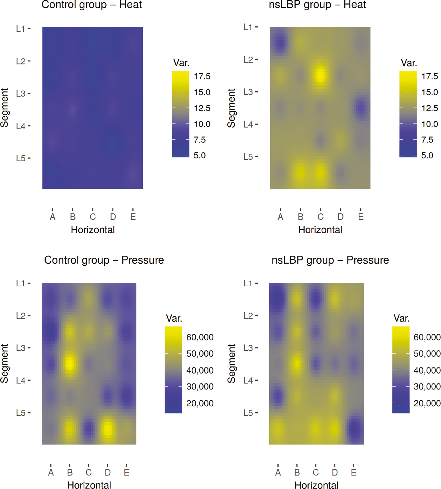 Fig. 4: 
            Heat maps of variation in pain threshold – lumbar. Spatial distribution of pain threshold variation by group. Y-axis (L5–L1) refers to lumbar segment. X-axis (A–E) refers to sagittal position, with C in the midline and A and E being midway to the Iliac crest. Units: Celsius2 (heat) and kPa2 (pressure). “nsLBP”=non-specific low-back pain.
          