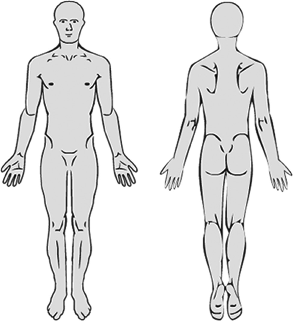 Fig. 3: 
            The pain drawing as presented to patients.
          