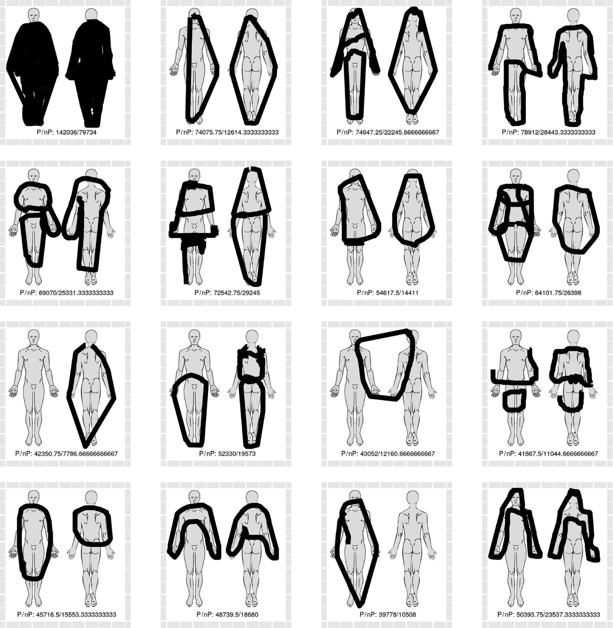 Fig. 9: 
            The sixteen pain drawings with the greatest discrepancy between polygon-based methods of area estimation (greater area estimates) and non-polygon-based methods (smaller area estimates). Numbers in drawing represent the area sum of the four polygon-based methods (P) and non-polygon-based methods (nP).
          