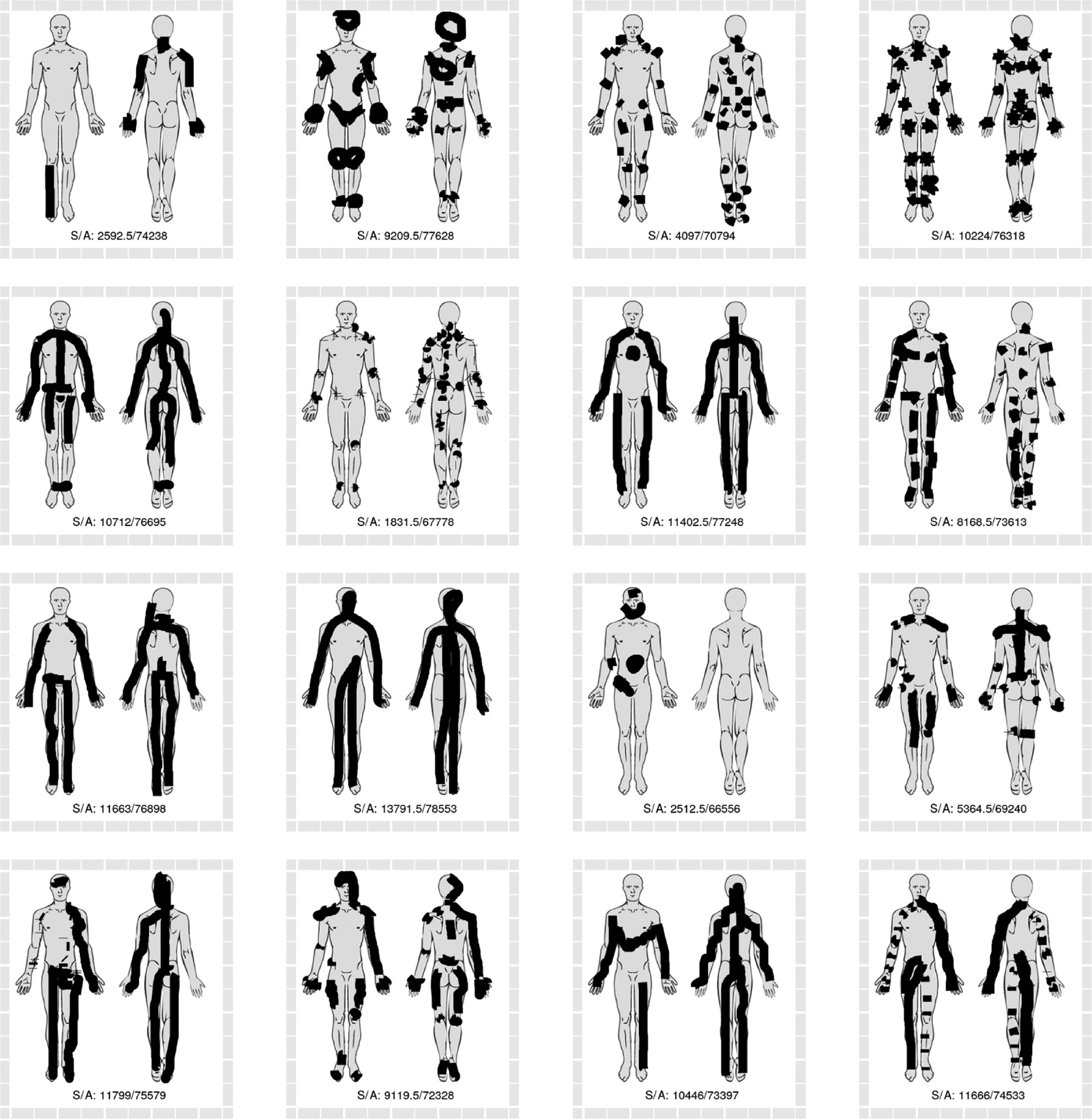 Fig. 11: 
            The sixteen pain drawings with the greatest discrepancy between methods based on raw SVG strokes (lesser area estimates) and methods based on anatomical regions (greater area estimates). Numbers in drawing represent the area sum of the two strokes based methods (S) and anatomy-based methods (A).
          