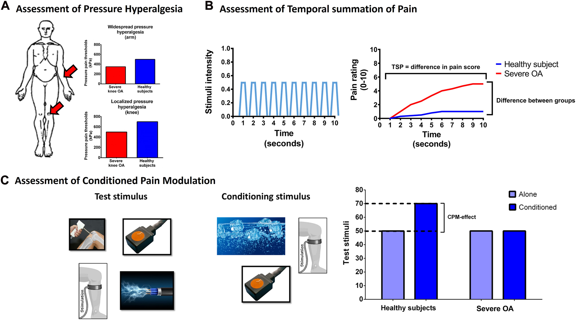 Figure 2: 
            Illustrations of assessments and outcomes of (A) pressure hyperalgesia, (B) temporal summation of pain (TSP), and (C) conditioned pain modulation (CPM) of patients with severe knee osteoarthritis (OA) when compared with healthy pain-free individuals.
            (A) Assessments of pressure pain thresholds (PPTs) at the knee (assessment of localized hyperalgesia) and at the arm (assessment of widespread hyperalgesia). (B) TSP relies on continuously fast stimuli with the same intensity and is calculated as the pain score to these painful stimuli over time. (C) Assessment of CPM requires a test stimulus and a conditioning stimulus, and multiple paradigms of test and conditioning stimuli have been utilized. In general, patients with severe OA demonstrate localized and widespread hyperalgesia, facilitated TSP and impaired CPM when compared with pain-free healthy individuals. The figure has been copied and modified with permission from the doctoral thesis by Kristian K. Petersen, 2021, Aalborg University, Denmark (link: chrome-extension://efaidnbmnnnibpcajpcglclefindmkaj/https://vbn.aau.dk/ws/portalfiles/portal/450213713/1061952_thesis_mechanistic_pain_profiling_of_patients_with_osteoarthritis_kkp.pdf).